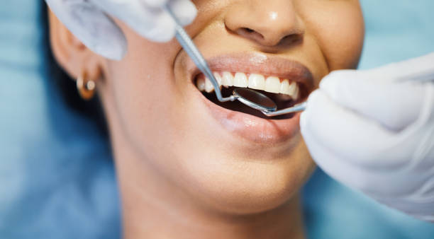 Best Emergency Wisdom Teeth Removal in Heber, UT